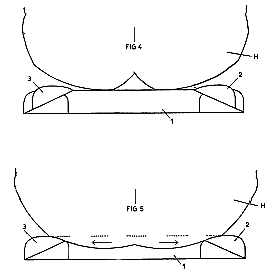 Patent drawing: FR2739014