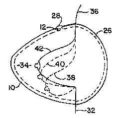 Patent drawing: US4734078